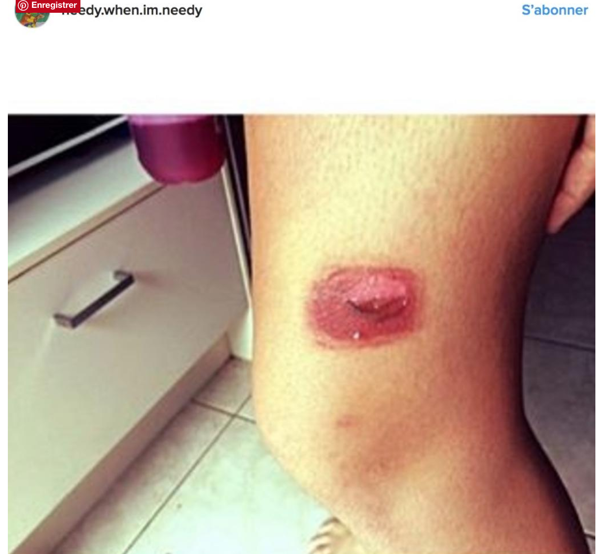 Illustration de l'article : Elle pense juste que sa fille s'est coup&eacute;e mais le m&eacute;decin lui r&eacute;v&egrave;le que c'est bien plus grave...