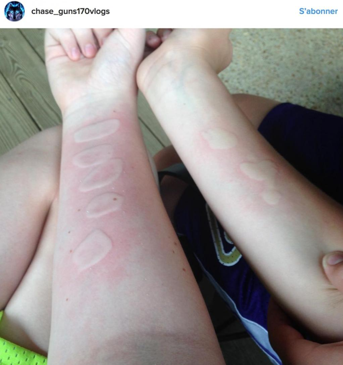 Illustration de l'article : Elle pense juste que sa fille s'est coup&eacute;e mais le m&eacute;decin lui r&eacute;v&egrave;le que c'est bien plus grave...