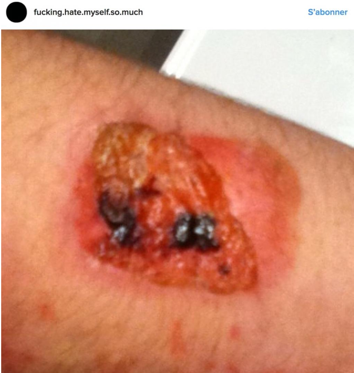 Illustration de l'article : Elle pense juste que sa fille s'est coup&eacute;e mais le m&eacute;decin lui r&eacute;v&egrave;le que c'est bien plus grave...