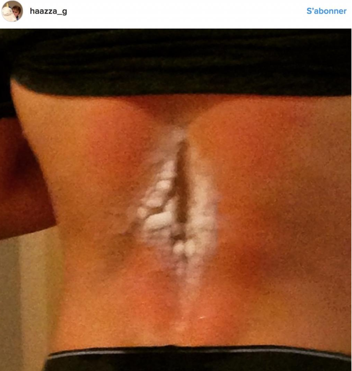 Illustration de l'article : Elle pense juste que sa fille s'est coup&eacute;e mais le m&eacute;decin lui r&eacute;v&egrave;le que c'est bien plus grave...