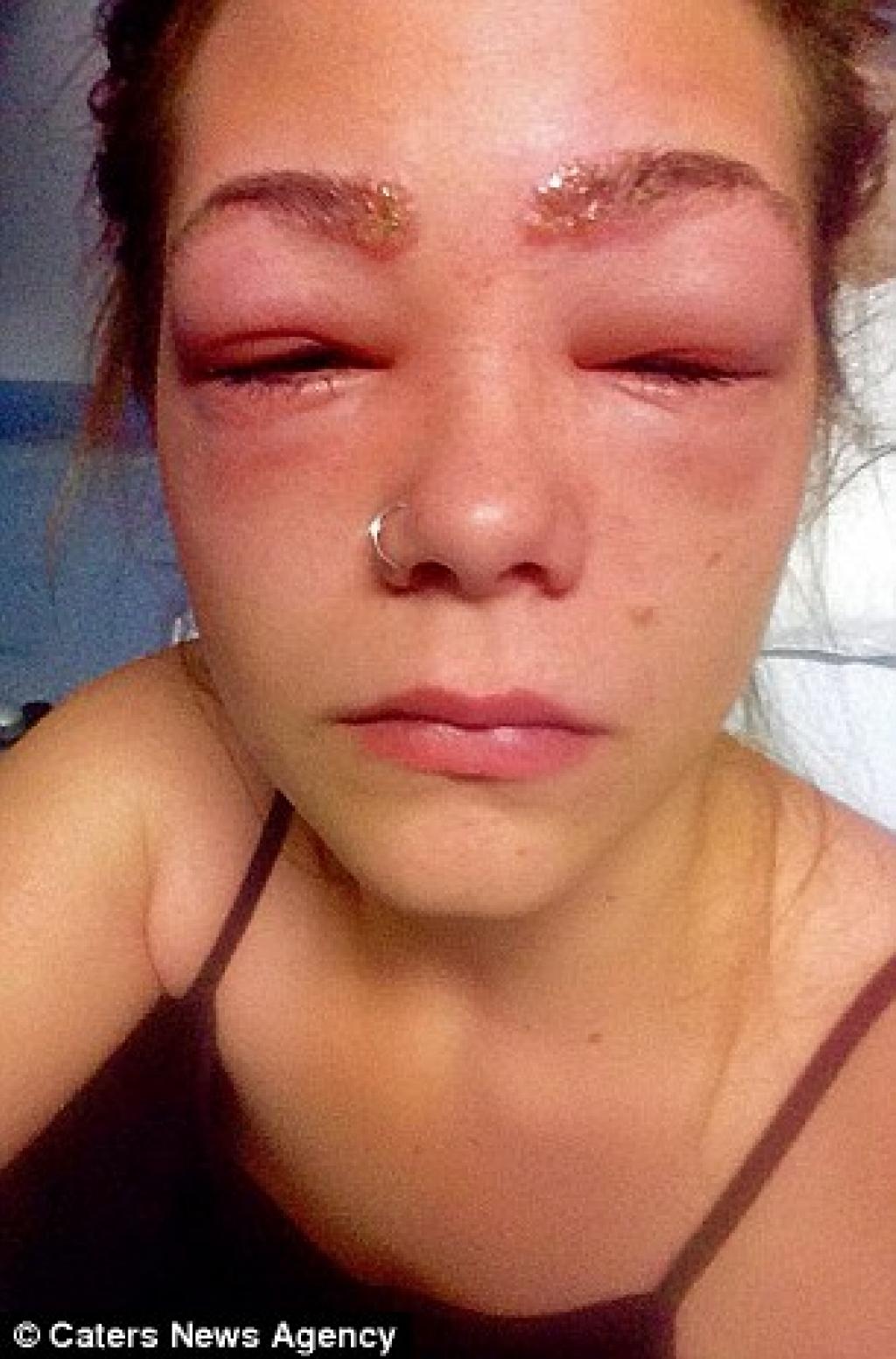 Illustration de l'article : Elle &eacute;tait &agrave; deux doigts de finir aveugle &agrave; cause d'une pratique que font de plus en plus de femmes !