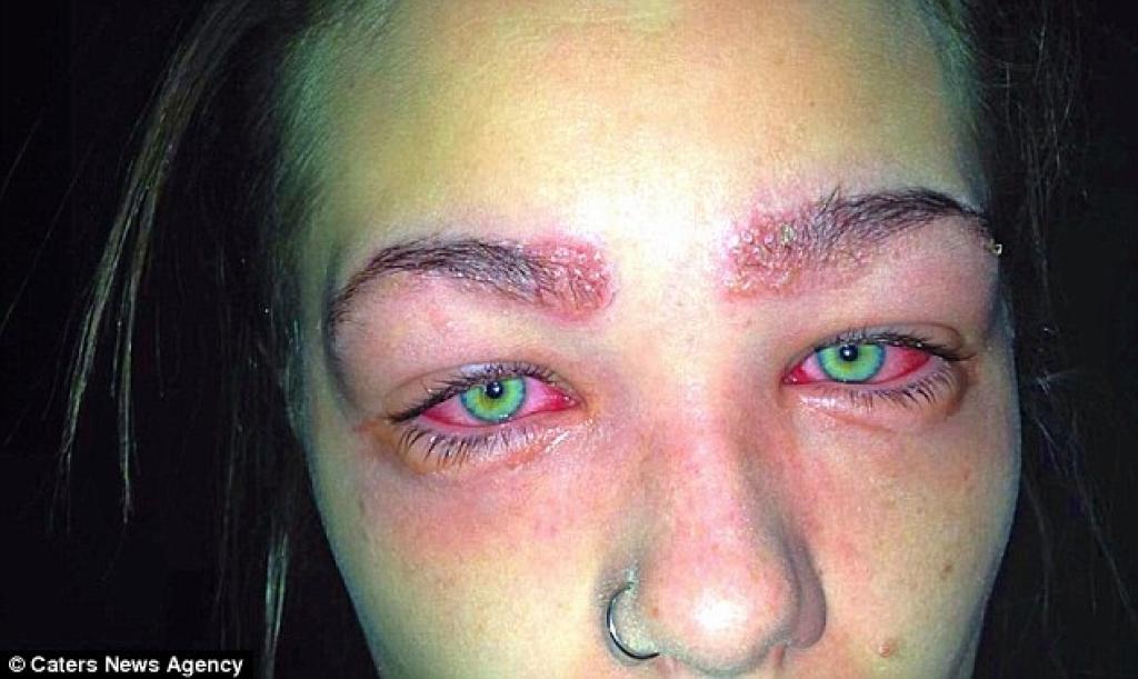 Illustration de l'article : Elle &eacute;tait &agrave; deux doigts de finir aveugle &agrave; cause d'une pratique que font de plus en plus de femmes !