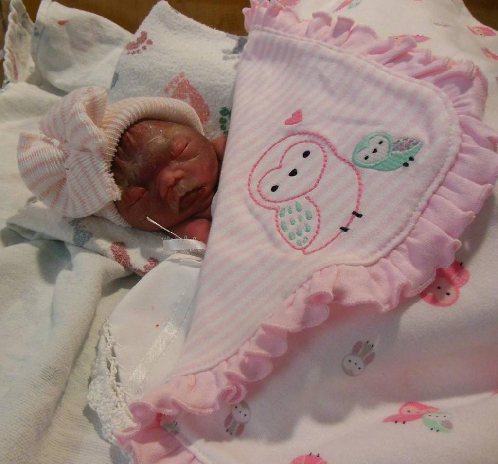 Illustration de l'article : Avant de mourir, elle attache son b&eacute;b&eacute; et le jette par la fen&ecirc;tre. En trouvant le petit comme &ccedil;a, la police est sous le choc!