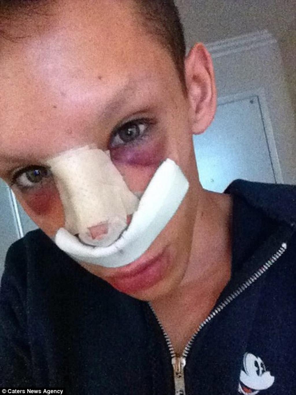 Illustration de l'article : 110 Chirurgies Et 50.000€ Pour Réaliser Son Rêve... Devenir Un Extra-Terrestre Sans S*xe!