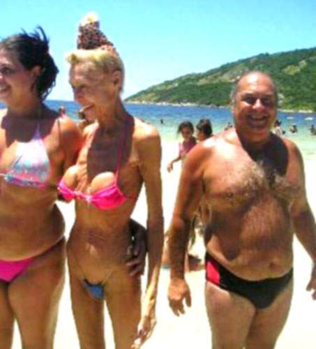 Illustration de l'article : 18 augmentations mammaires horriblement ratées! Grosse pensée aux copains des filles 13, 14 et 17...