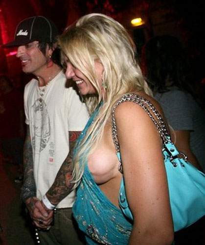 Illustration de l'article : 18 augmentations mammaires horriblement ratées! Grosse pensée aux copains des filles 13, 14 et 17...