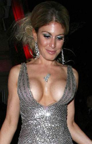 Illustration de l'article : 18 augmentations mammaires horriblement ratées! Grosse pensée aux copains des filles 13, 14 et 17...