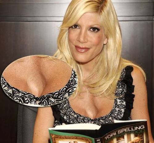 Illustration de l'article : 18 augmentations mammaires horriblement ratées! Grosse pensée aux copains des filles 13, 14 et 17...