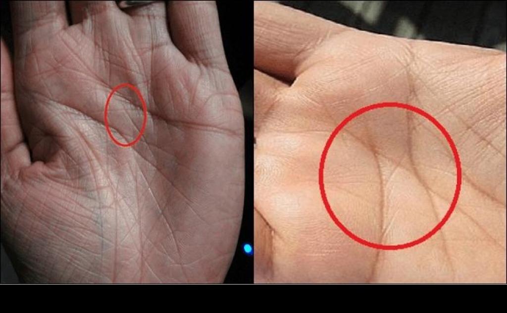 Illustration de l'article : Voici ce que signifie cette marque dans la main, visible uniquement chez 3 personnes sur 100!