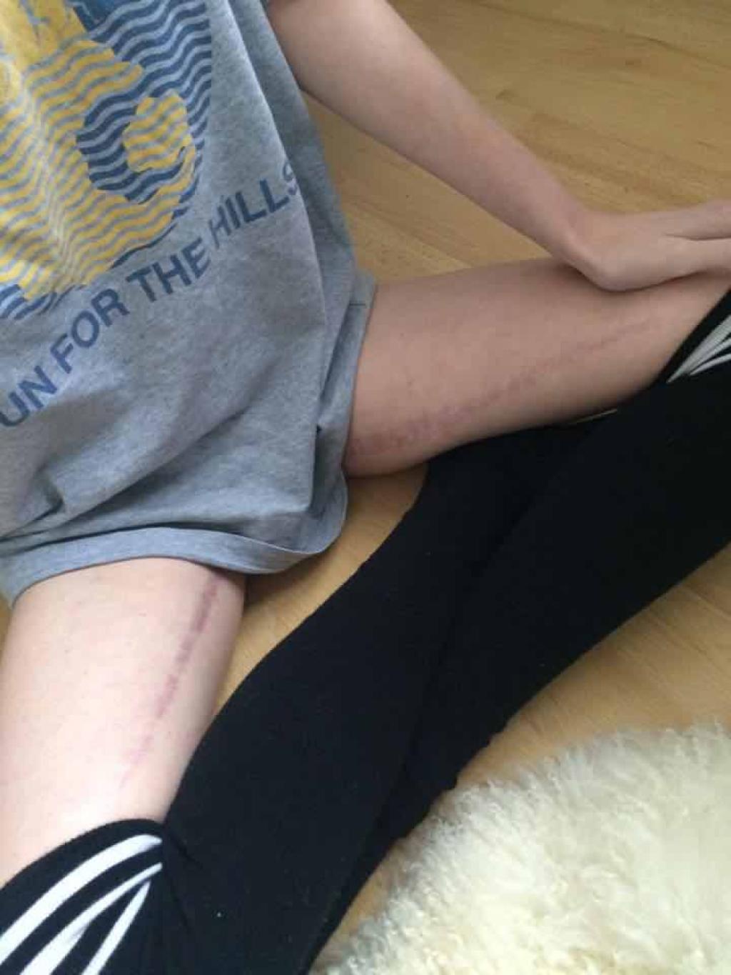 Illustration de l'article : Elle se dévoile en photo pour dire qu'il n'y a pas a avoir honte de ce qu'elle a entre les jambes!