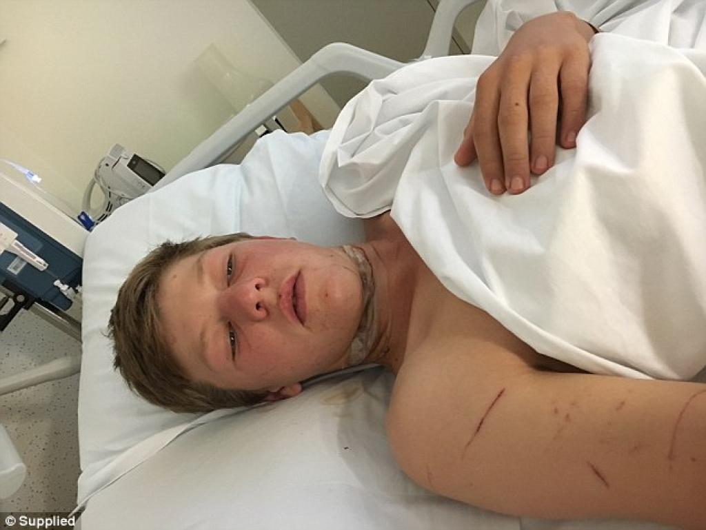 Illustration de l'article : Attention: &Eacute;couteurs et casque de moto sont tr&egrave;s dangereux ! Ce jeune de 16 ans n'est pas pass&eacute; loin du drame!