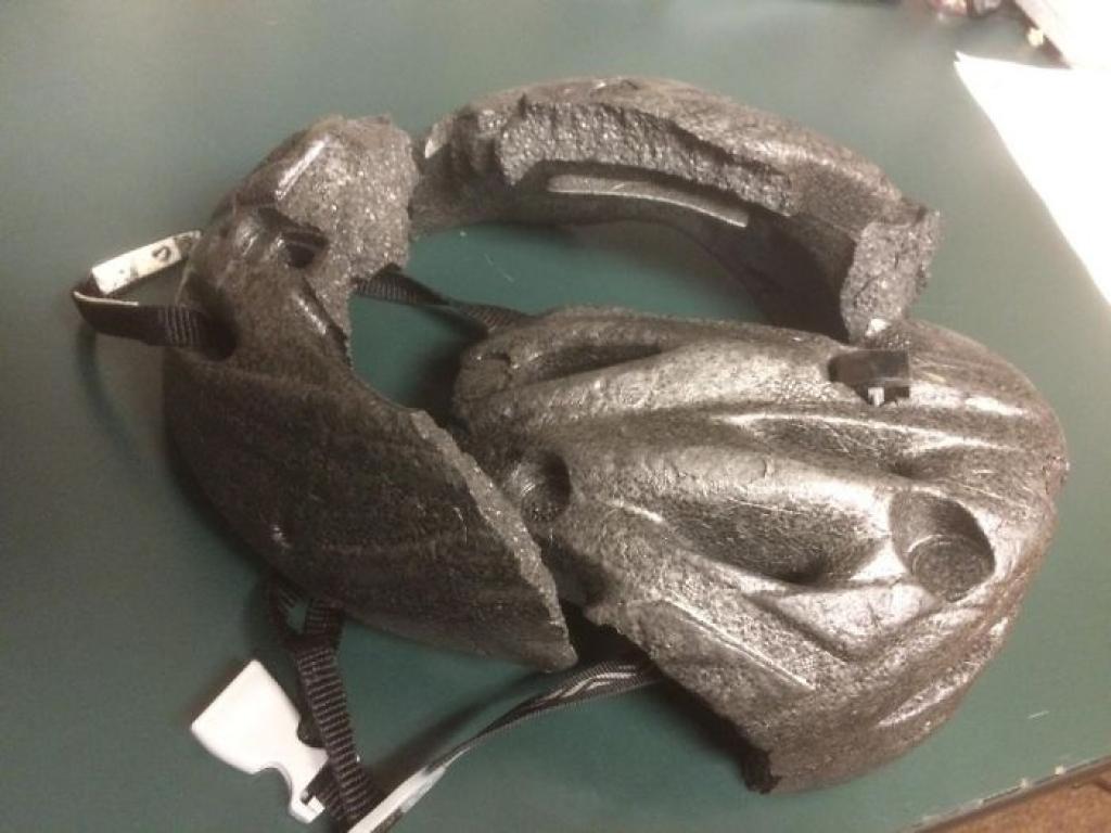 Illustration de l'article : Avec Ces 26 Photos, On Comprend Pourquoi Il Faut Toujours Porter Un Casque!