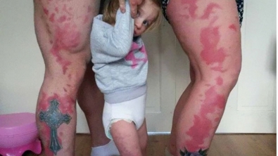 Illustration : "Ces parents se font tatouer des taches de naissance pour aider leur fille à mieux vivre avec la sienne !"