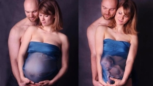 Illustration : "Top 36 des photos de grossesses les plus improbables du moment..."