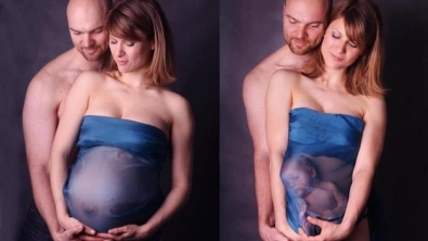 Illustration : "Top 36 des photos de grossesses les plus improbables du moment..."