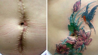 Illustration : "Elle propose des tatouages gratuits pour couvrir les cicatrices de ces grandes blessées de la vie"