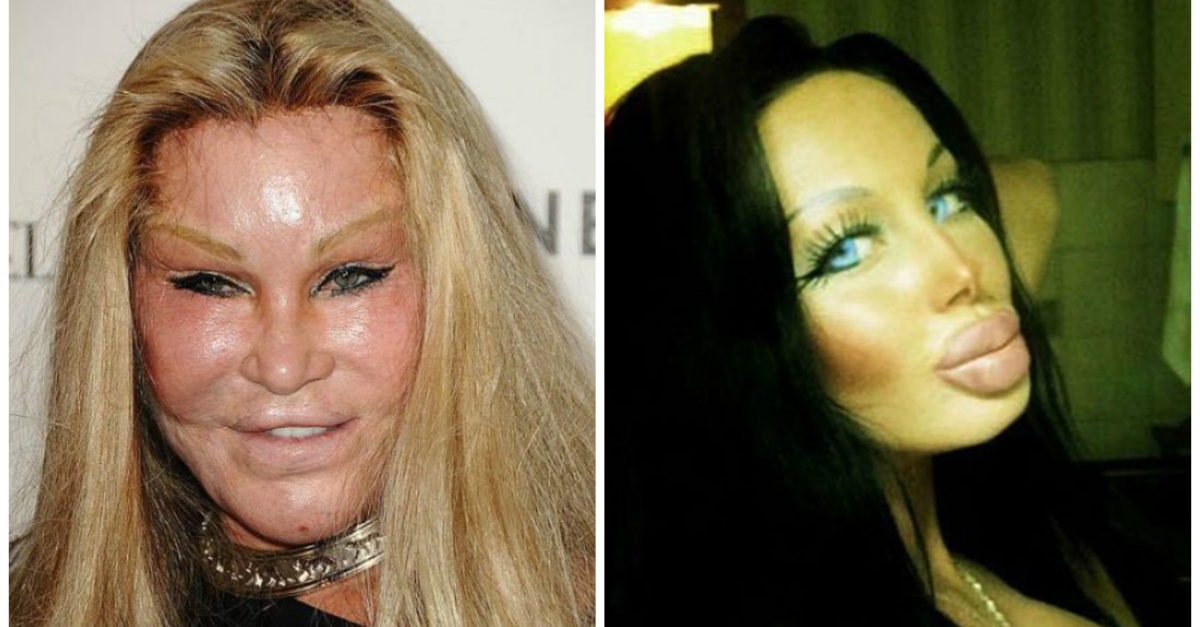 15 opérations de chirurgie esthétique complètement ratées