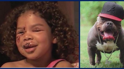 Illustration : "Attaquée au visage par un Labrador, c'est son pitbull qui lui vient en aide... Regardez:"