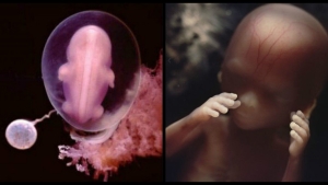 Illustration : "La naissance d'un bébé étape par étape, illustrée par 23 photos magnifiques..."