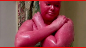 Elle Vient D Accoucher Et C Est Le Choc Pour Les Parents L Apparence Du Bebe Est Terrifiante Elle Vient D Accoucher Et C Est Le Choc Pour Les Parents L Apparence Du Bebe Est Terrifiante