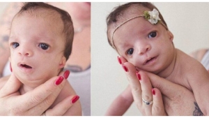 Image illustrant l'article Elle voulait faire adopter son bébé mais en voyant son visage, ce qu'elle a fait est magnifique !