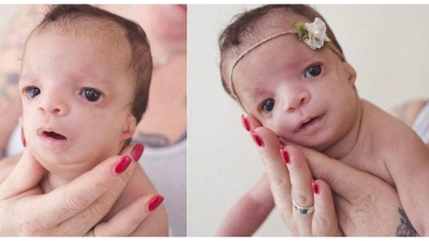Illustration : "Elle voulait faire adopter son bébé mais en voyant son visage, ce qu'elle a fait est magnifique !"