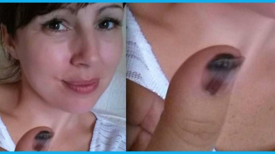 Illustration : "En voyant ce point noir sur son pouce, cette femme n'y a prêté aucune attention... Pourtant voici ce qu'elle a découvert: "