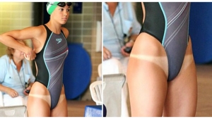 Image illustrant l'article Les 24 marques de bronzage les plus embarrassantes de cet été...