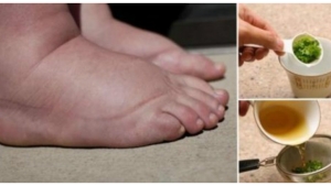 Illustration : "Une méthode naturelle à base de persil pour le traitement de vos pieds gonflés !"