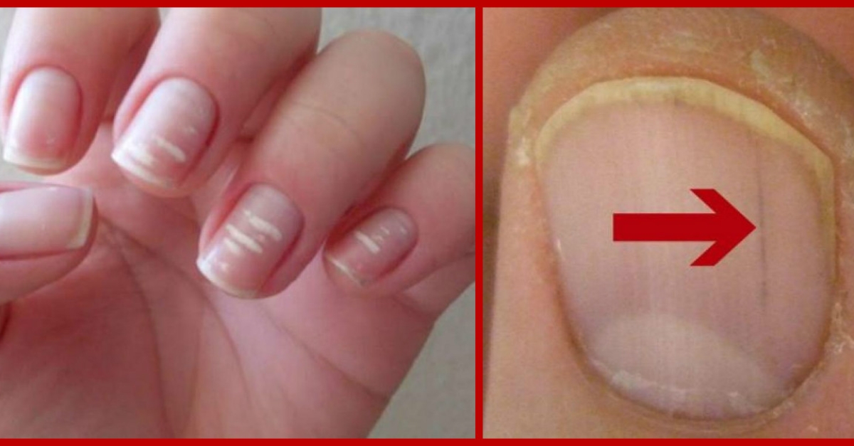 Nail art en gel uv blanc et argent pailleté + arabesques blanches - Les  Ongles d'Audrey 91