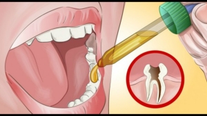 Illustration : "Votre dentiste ne vous le dira peut-être pas mais vous pouvez faire ce remède naturel contre vos rages de dents !"