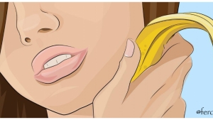 Illustration : "La peau de banane contre les boutons et l'acné. 6 astuces naturelles !"