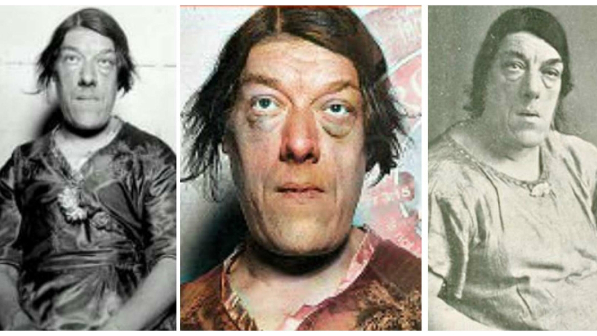 Mary Ann Bevan élue femme la plus laide du monde, elle a tout sacrifié pour ses enfants...