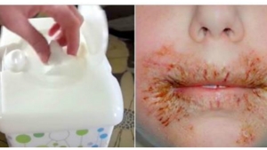 Illustration : "Attention, avis des docteurs: Ne nettoyez jamais plus le visage des enfants avec des lingettes pour bébé!"