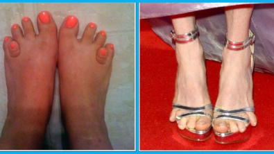 Illustration : "Top 19 des plus moches photos de pieds... De quoi décomplexer !"