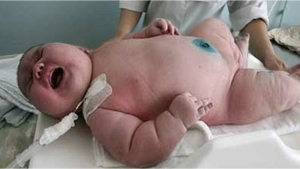 Illustration : "Enquête: Une mère Australienne de 300 kilos a-t-elle vraiment donné naissance à un enfant de 20 kilos ?"
