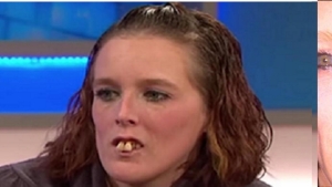 Illustration : "Humiliée et harcelée juste pour ses dents, voici ce qu'elle est devenue après 12 000$ d'opération."