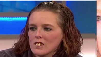 Illustration : "Humiliée et harcelée juste pour ses dents, voici ce qu'elle est devenue après 12 000$ d'opération."