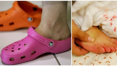 Illustration : "Importante mise en garde d'un médecin contre les chaussures crocs !"