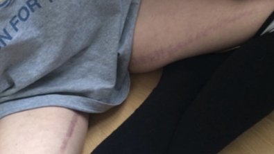 Illustration : "Elle se dévoile en photo pour dire qu'il n'y a pas a avoir honte de ce qu'elle a entre les jambes!"