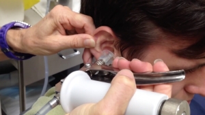 Image illustrant l'article Le docteur voit de l’eau s’écouler de l’oreille du patient, mais ce qu’il en extrait juste après… Le pauvre !