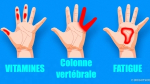 Illustration : "7 Trucs Importants Que Vos Mains Cherchent À Vous Dire Sur Votre Santé!"