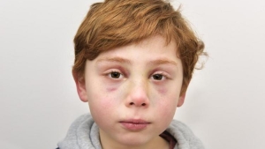 Image illustrant l'article Un enfant de 7 ans a été tué par ses parents, ce que le docteur trouve dans sa main m'a retourné le coeur!