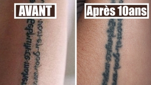 Illustration : "Vous pensez faire un tatouage ? Ces 27 photos montrent ce qu'ils deviennent après des années..."